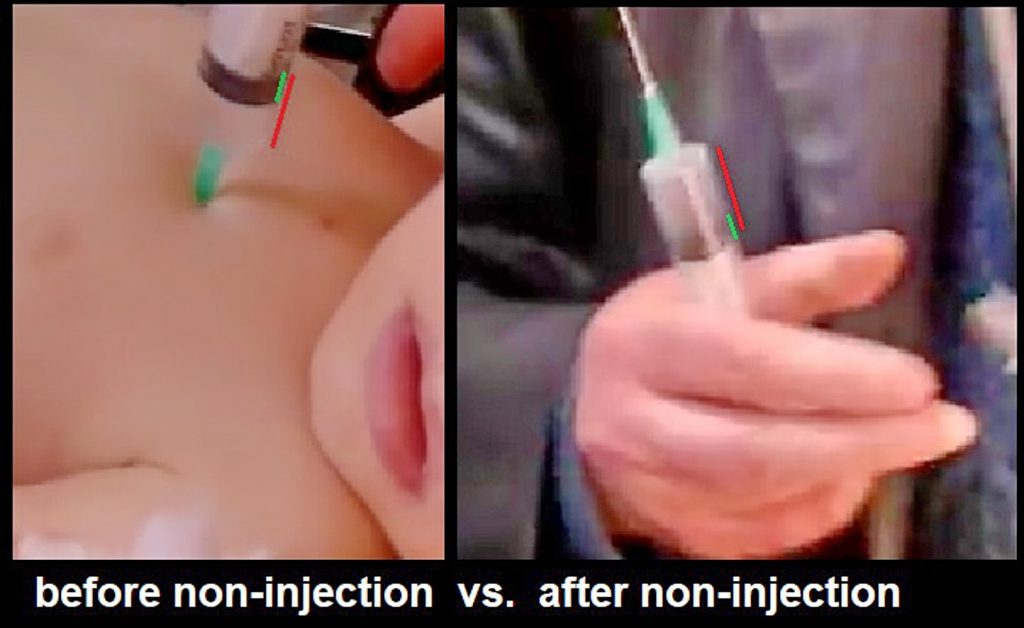 Refuting the Coda Story’s narrative on Swedish Doctors for Human Rights